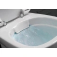 Подвесной унитаз IFO Sjoss Rimfree RP313200500 без ободка — современный дизайн и гигиеничность - миниатюра фото 9